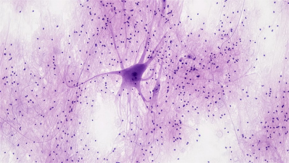 Fluorescence microscopy image of a spinal cord motor neuron. The 4 types of glial cells - the other half of your brain nobody talks about. Recalibrate neuroscience blog.