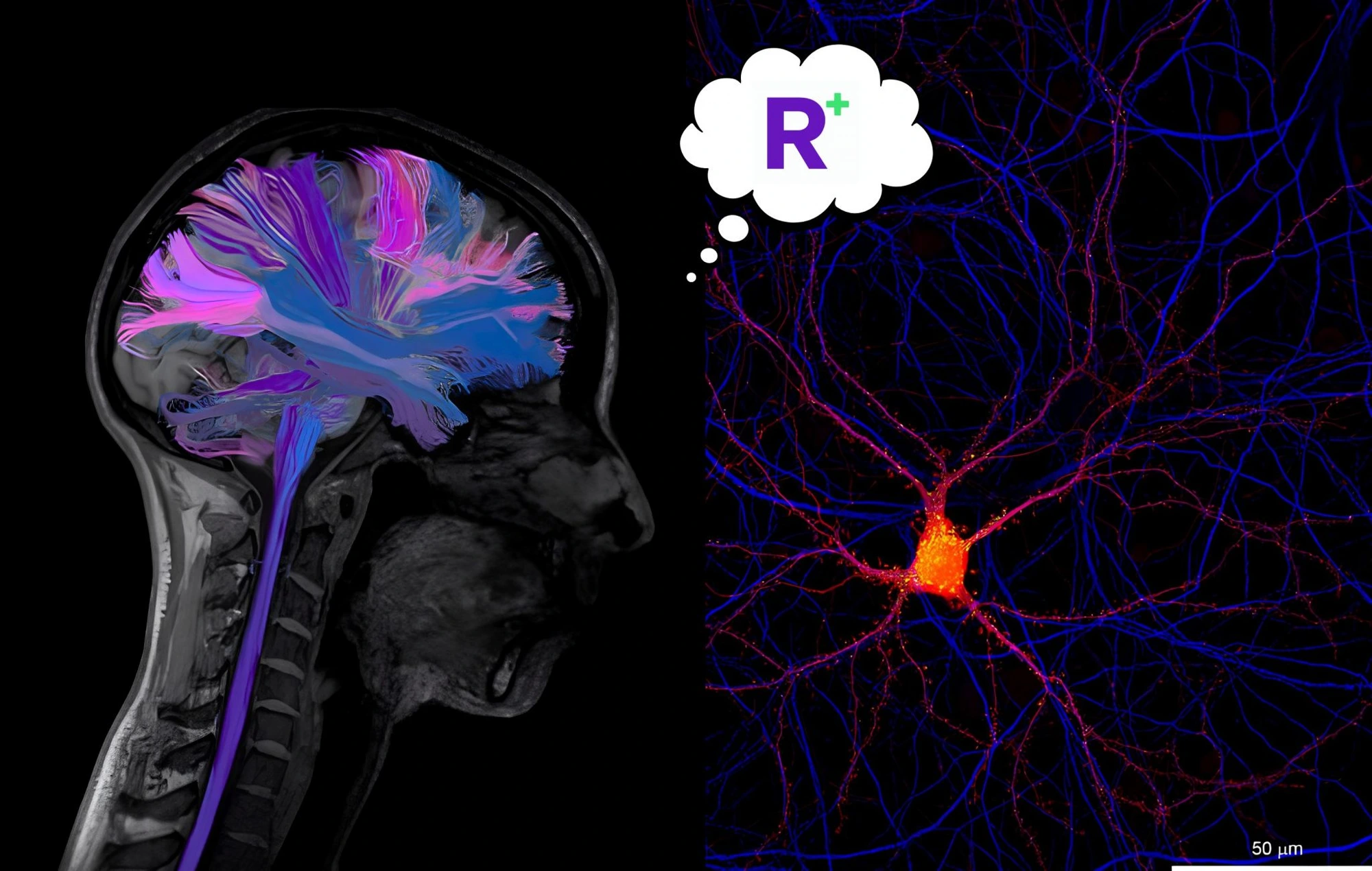 Structural MRI of the human brain with neural pathways and a fluorescence microscopy neuron image. The architecture your nervous system uses to suppress symptoms under stress - and release them the moment you stop. Recalibrate neuroscience blog.