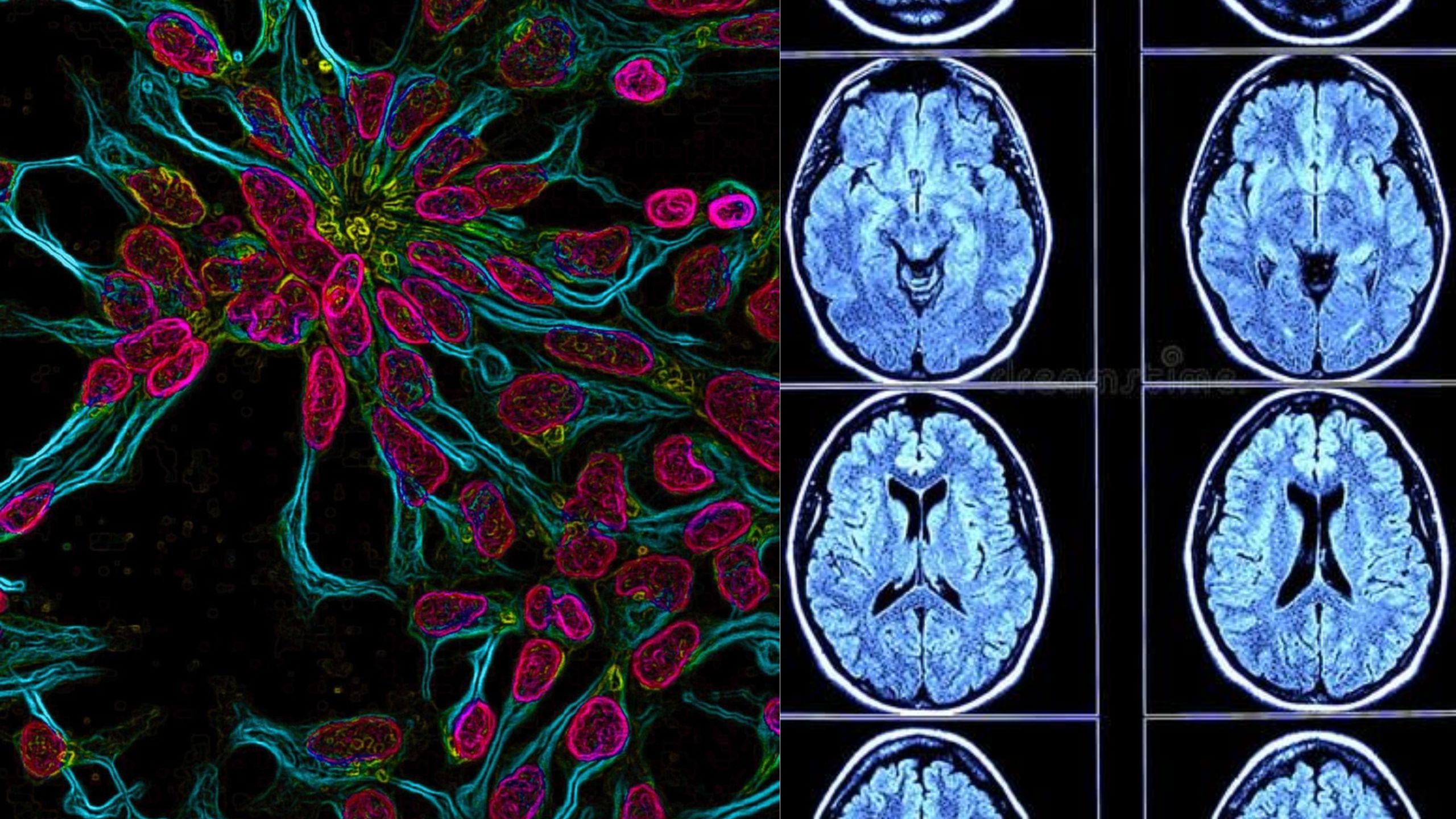 Fluorescence microscopy of living neurons and structural MRI of the human brain. Your brain responds to self-talk with the same architecture it uses for real threats. Recalibrate neuroscience blog.